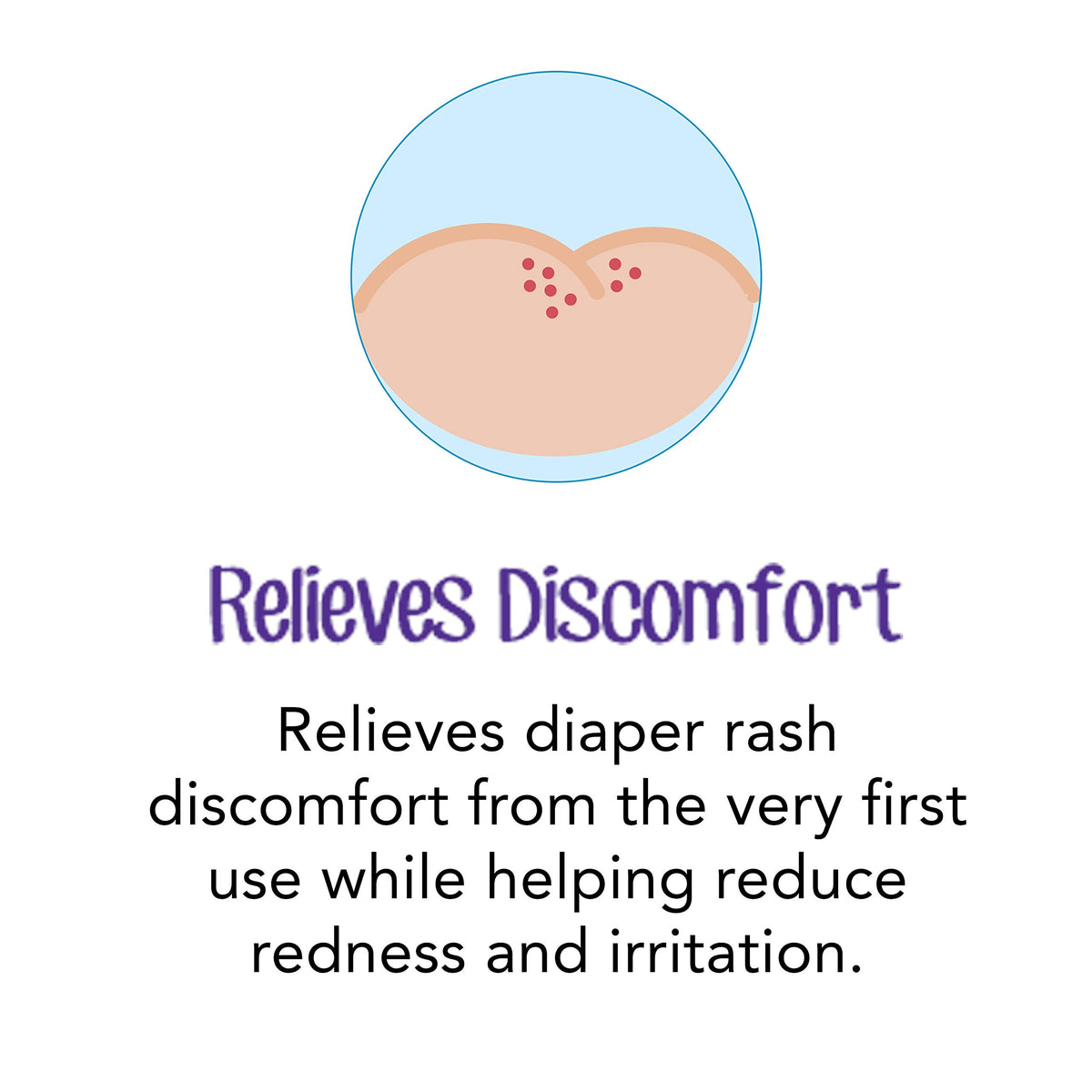 Desitin Daily Defense Baby Diaper Rash Cream with Zinc Oxide to Treat, Relieve & Prevent diaper rash, Hypoallergenic, Dye-, Phthalate- & Paraben-Free, 4 oz