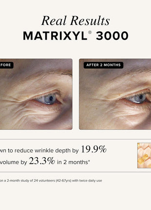 Asterwood Matrixyl 3000 & Argireline Peptide Serum with Hyaluronic Acid
