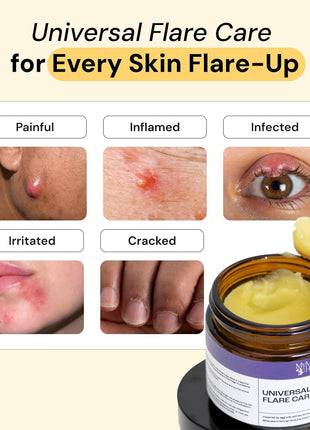 MyMagicHealer Universal Flare Care | Drawing Salve for HS, Boils, Cysts, Hemorrhoids, Pilonidal Cyst, Abscess | Anti Chafing, Wound Care, Relief for Itching Skin w/Propolis & Egg Yolk Extract 4 oz