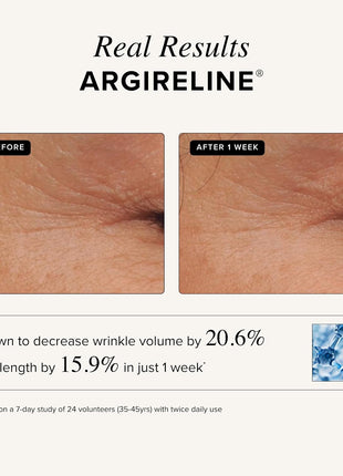 Asterwood Matrixyl 3000 & Argireline Peptide Serum with Hyaluronic Acid