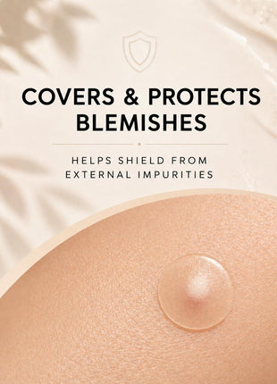 Hydrocolloid Pimple Patches (144 Count, 8mm & 12mm) – Nearly Invisible, Ultra Thin Spot Cover, Day & Night Use.