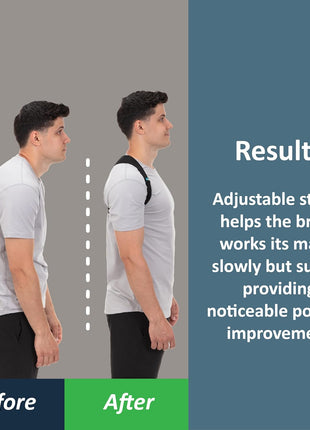 ComfyBrace Posture Corrector-Back Brace for Men and Women- Fully Adjustable Straightener for Mid, Upper Spine Support- Neck, Shoulder, Clavicle and Back Pain Relief-Breathable