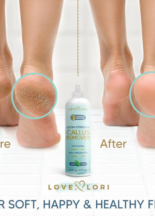 Love Lori Foot Callus Remover Gel Extra Strength Pedicure Tool for Feet 6oz | Quickly, easily, softens and removes dead, hard skin on heels & feet; salon-quality pedicure results at home
