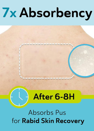 Large Pimple Patches for Face - Hydrocolloid Nose, Chin, and Forehead Acne Patches for Full Face Coverage - Big Acne Patches for Large Blemish - Day & Night Use (Intensive-XL/10 Dots)