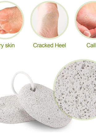 2PCS Natural Pumice Stone, Asqraqo Lava Pedicure Tools Hard Skin Callus Remover for Feet and Hands - Foot File Exfoliation to Remove Dead Skin, and Callusess