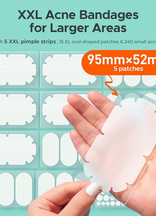 TKTK Pimple Patches Pimple Patches for Face Hydrocolloid Acne Patches Zit Patches for Chin and Nose Skin Care 5 Sizes 136 Count