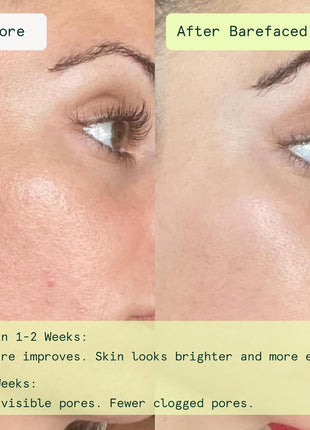 Barefaced Toning and Exfoliating Pads | Glycolic and Salicylic Acid Face Wipes for Blemishes, Dark Spots, and Uneven Texture | Daily Resurfacing Peels for Clear, Glowing Skin (60 Pads)