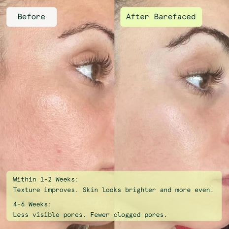 Barefaced Toning and Exfoliating Pads | Glycolic and Salicylic Acid Face Wipes for Blemishes, Dark Spots, and Uneven Texture | Daily Resurfacing Peels for Clear, Glowing Skin (60 Pads)