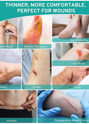 Hydrocolloid Roll for Wound Care Skin-Friendly Self Adhesive 2in x 12ft | Cut-to-Size Waterproof Hydrocolloid Bandages with Flexible Fit for Minor Wounds, Blisters, Pimples, and Friction