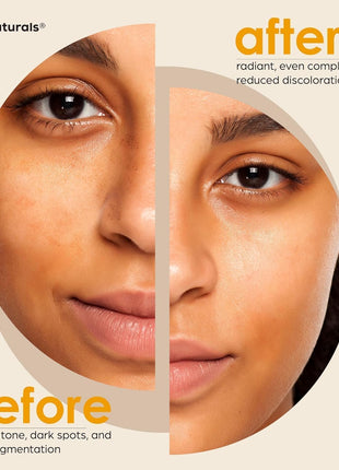 Kojic Acid Soap + African Net Sponge (2 pack x 142g Turmeric bars) Dark spot remover & Scars   Original Japanese Complex Vitamin C, Hyaluronic Acid, retinol, shea butter (Citrus)