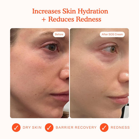 Tower 28 SOS Recovery Face Cream - Hydrating Face Moisturizer with Hyaluronic Acid + Ceramides - Skin Barrier Repair Moisturizer Reduces Redness + Improves Texture - Sensitive Skin Care (1.86 oz)
