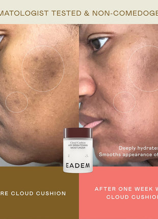 EADEM Face Moisturizer Barrier Repair Cream for Women, Cloud Cushion