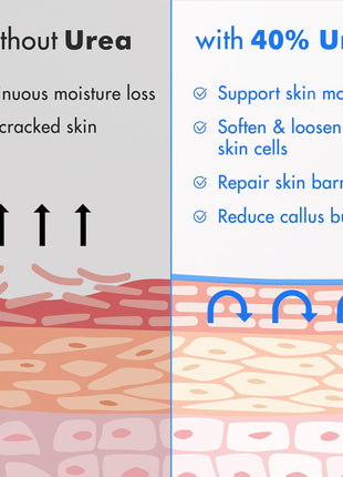 Ebanel Urea Cream 40% plus Salicylic Acid 2%, Foot Cream for Dry Cracked Heels Feet Knees Elbows Hands, Foot Dead Skin Cuticle Callus Remover Toenail Softener, Keratolytic Skin Barrier Repair