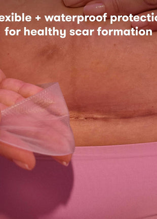 Frida Mom C-Section Silicone Strips, C-Section Recovery Must Have Scar Patches, Reusable Medical Grade Treatment for Keloid Scars, Includes Case & Pouch