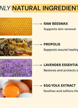 MyMagicHealer Universal Flare Care | Drawing Salve for HS, Boils, Cysts, Hemorrhoids, Pilonidal Cyst, Abscess | Anti Chafing, Wound Care, Relief for Itching Skin w/Propolis & Egg Yolk Extract 4 oz