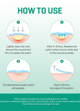 SOME BY MI 30 Days Miracle Clear Spot Patch - Pack of 5, 90 Counts, 2 Size(10mm 45Counts, 12mm 45Counts) - Invisible Hydrocolloid Skin Trouble and Pimple Patch with No Irritation - Korean Skin Care