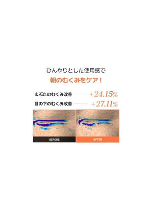 COSRX 5 PDRN Collagen, Vitalizing, Hydroel, Eye Patch, Partial Pack, Instant Firmness, Eye Pack, Eye Tone Up, Glorious Line, Neck Wrinkles, Hurricane, High Contact Patch, Swollen Care, Eyes and