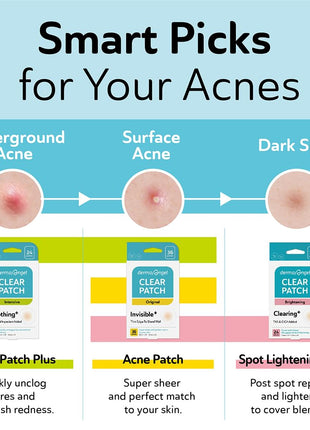 Large Pimple Patches for Face - Hydrocolloid Nose, Chin, and Forehead Acne Patches for Full Face Coverage - Big Acne Patches for Large Blemish - Day & Night Use (Intensive-XL/10 Dots)