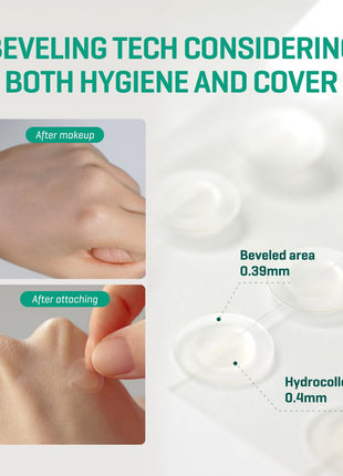 SOME BY MI 30 Days Miracle Clear Spot Patch - Pack of 5, 90 Counts, 2 Size(10mm 45Counts, 12mm 45Counts) - Invisible Hydrocolloid Skin Trouble and Pimple Patch with No Irritation - Korean Skin Care