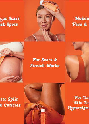 Bio-Oil Skincare Body Oil Serum, Scars & Stretch Marks, 6.7 fl oz | Dermatologist Recommended, Vitamin E & A, Dry & Sensitive Skin, Non-Comedogenic, Face and Body, Scar Treatment