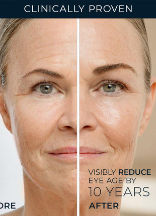 RoC Retinol Correxion Under Eye Cream for Dark Circles & Puffiness, Daily Wrinkle Cream, Anti Aging Skin Care Treatment Women and Men, 0.5 oz (Packaging May Vary)