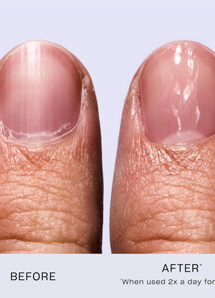 OPI Nail Envy Nail Strengthener Clear | Strengthening Nail Polish Treatment | For Weak & Thin Nails