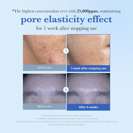 medicube Exosome Shot Zero 25,000 PPM Spicule Facial Serum