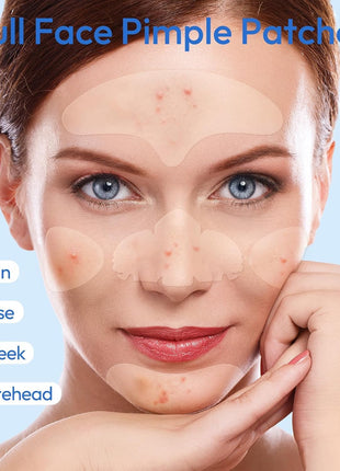 Full Face Pimple Patches (5 Pack, 25 Patches),XL Hydrocolloid Acne Patches for Whole Face,Nose,Chin,Forehead,Cheeks w/Tea Tree Oil&Salicylic Acid,Large Invisible Zit Patches for Overnight Blemish Care