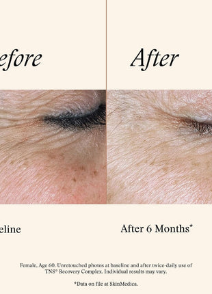 SkinMedica TNS Recovery Complex Facial Treatment - Advanced Growth Factor & Exosome Formula for Skin Rejuvenation - Helps to Improve the Appearance of Fine Lines, Wrinkles, and Uneven Skin Tone (1 Oz)
