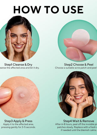 QUSTERE 580 Count Pimple Patches for Face, Large Hydrocolloid Acne Patches Stickers Bandages, Blemishes Zit Breakouts for Cheeks, Forehead, Chin, Nose for Full Face & Body | 7 Sizes | 4 Shapes