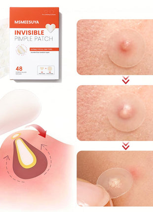 Pimple Patches 96 Count, Hydrocolloid Acne Patches, 2 Pack | Hydrocolloid acne patches provide discreet coverage for blemishes. Invisible round and heart shapes for day and night use