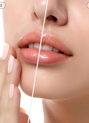 Facial Hair Remover for Women - as Seen on TV Painless Face Shaver - Electric Hair Removal Device for Face Lips Peach Fuzz with Light (Rose Gold)