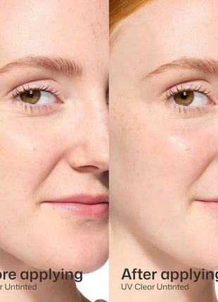 EltaMD UV Clear Face Sunscreen SPF, Oil-Free Sunscreen with Zinc Oxide, Dermatologist Recommended