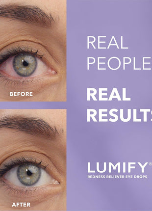 LUMIFY Eye Drops for Red Eyes, Redness Reliever for Brighter Looking Eyes, Works in 1 Minute & Lasts Up to 8 Hours, Eye Drops, 0.25 Fl Oz (7.5mL)
