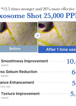 medicube Exosome Shot Zero 25,000 PPM Spicule Facial Serum