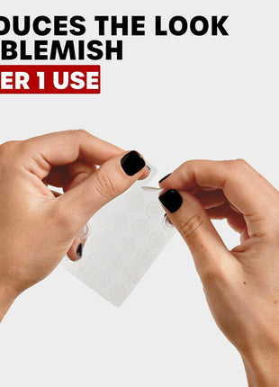 THAYERS Invisible S.O.S Hydrocolloid Acne Pimple Patch, Ultra-Thin Design Instantly Reduces Look of Blemishes, Set of 22 Pimple Patches