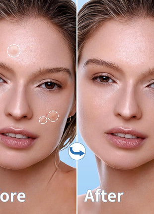 Daolyo Pimple Patches for Face, 4 Size 300 Counts Acne Patches, Hydrocolloid Patches for Covering Zits and Blemishes, Spot Stickers with Salicylic Acid, Tea Tree Oil & Calendula Oil