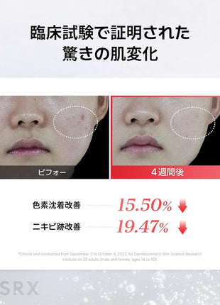 COSRX Niacinamide Beauty Serum Niacinamide 15 Serum 20ml Niacinamide 15% Lotion Highest Content in Its Class Zinc PCA Problem Care Trouble Care Blackheads Whiteheads Sensitive Skin Skincare Basic
