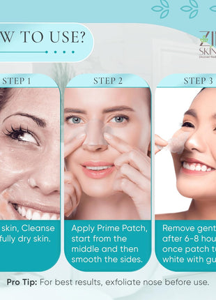 Prime Patch Nose Patches – Hydrocolloid Patches for Pimple & Zit Removal, Blackhead & Pore Care – Absorbs Acne Gunk & Oil, Strong Adhesion, Easy Removal, Vegan, 10 Count – Made in Korea
