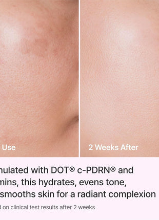 REJURAN Triple Radiance Cream, DOTTM c-PDRN® 0.2% Moisturizer, 1.69 fl oz