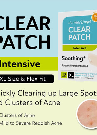 Large Pimple Patches for Face - Hydrocolloid Nose, Chin, and Forehead Acne Patches for Full Face Coverage - Big Acne Patches for Large Blemish - Day & Night Use (Intensive-XL/10 Dots)