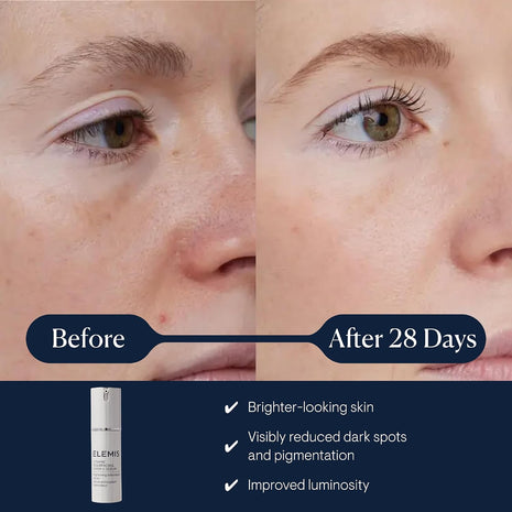 ELEMIS Dynamic Resurfacing Super-C Serum, Daily Anti-Aging Serum, 30ml