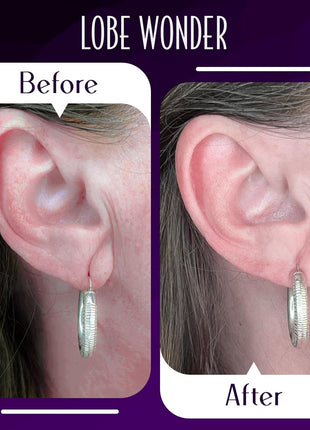 Lobe Wonder - The ORIGINAL Ear Lobe Support Patch for Pierced Ears - Eliminates the Look of Torn or Stretched Piercings - Protects Healthy Ear Lobes from Tearing - 60 Patches - Clear & Latex-Free