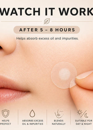 Hydrocolloid Pimple Patches (144 Count, 8mm & 12mm) – Nearly Invisible, Ultra Thin Spot Cover, Day & Night Use.