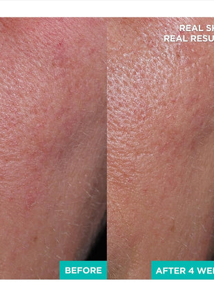 AESTURA A-CICA Toner Pads and A-CICA Cream