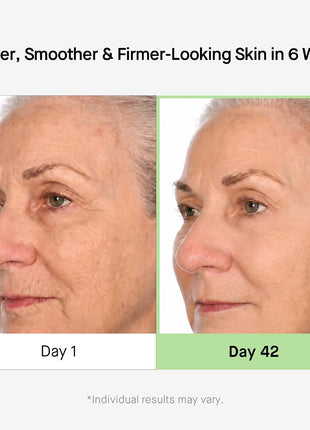 HealthyDerm 3D Stem Cell Matrixyl 3000 Peptides Complex Serum for Face