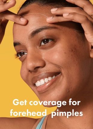 Mighty Patch Hero Cosmetics Forehead Large Acne Pimple Patches, 5 Ct | Hydrocolloid Acne Patches, Contoured to Cover Larger Area of Zits and Blemishes, Drug-Free, Suitable for Sensitive Skin