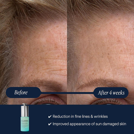 ELEMIS Pro-Collagen Renewal Serum for Smoothing Fine Lines & Wrinkles, 15ml