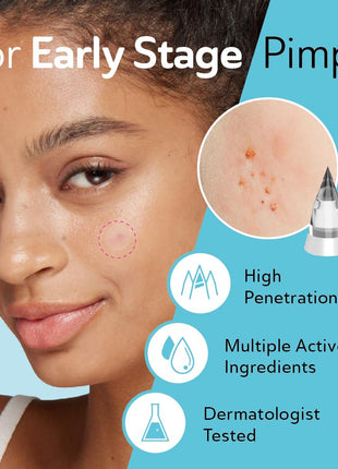 Microdart Acne Patches for Deep Blemishes - 18 Pimple Patches - Hydrocolloid Pimple Patch with Salicylic Acid, Azelaic Acid, CICA & Vitamin C - Targets Stubborn Blemishes Dark Spots & Cystic Acne