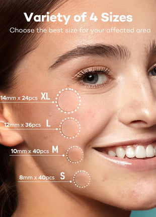 TKTK Pimple Patch for Face, Hydrocolloid Acne Absorbing Dots, 4 Sizes 140CT